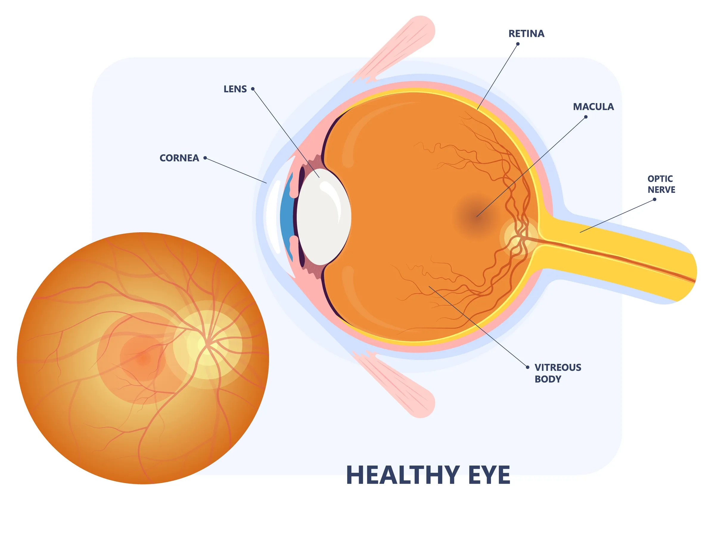 macular-degeneration-1